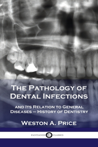 Pathology of Dental Infections: and Its Relation to General Diseases - History of Dentistry