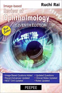 Review of Ophthalmology 7e