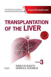 Transplantation of the Liver