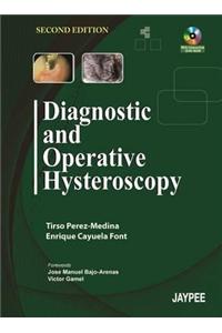 Diagnostic and Operative Hysteroscopy