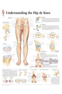 Understanding the Hip & Knee Laminated Poster