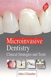 Microinvasive Dentistry