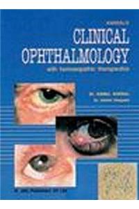 Clinical Ophthalmology