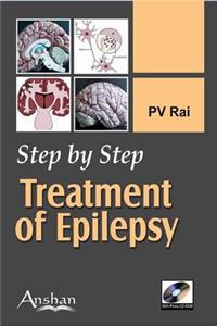 Step by Step: Treatment of Epilepsy