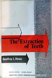 Extraction of Teeth