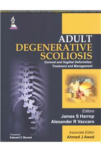 Adult Degenerative Scoliosis