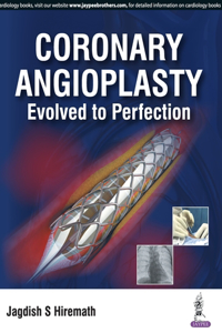 Coronary Angioplasty Evolved To Perfection