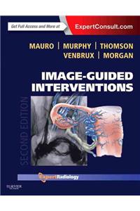 Image-Guided Interventions