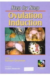 Step by Step: Ovulation Induction