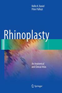 Rhinoplasty