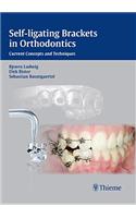 Self-ligating Brackets in Orthodontics