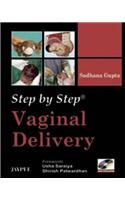 Step by Step: Vaginal Delivery