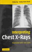 Interpreting Chest X-Rays Illustrated with 100 Cases