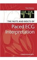 The Nuts and bolts of Paced ECG Interpretation