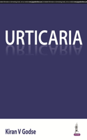 Urticaria