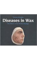 Diseases in Wax