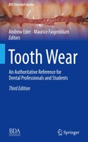 Tooth Wear