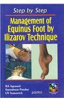 Step by Step: Management of Equinus Foot by Ilizarov Technique