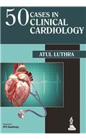 50 Cases in Clinical Cardiology