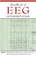 Handbook of EEG Interpretation