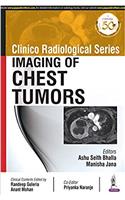 Clinico Radiological Series: Imaging of Chest Tumors