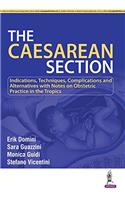 Caesarean Section