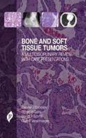 Bone and Soft Tissue Tumors