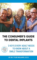 Consumer's Guide to Dental Implants