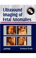 Ultrasound Imaging of Fetal Anomalies(Dr Kuldeep's Obstetric Sonology Series)