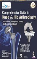 Comprehensive Guide in Knee & Hip Arthroplasty