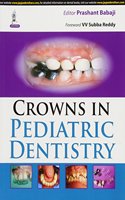 Crowns in Pediatric Dentistry