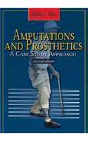 Amputations and Prosthetics