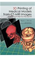 3D Printing of Medical Models from CT-MRI Images