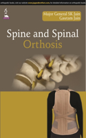 Spine and Spinal Orthosis