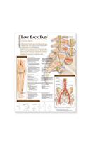 Understanding Low Back Pain Anatomical Chart