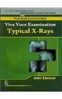 Typical X-Rays (Handbooks In Orthopedics And Fractures Series, Vol. 65-Practical Examination)