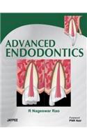 Advanced Endodontics