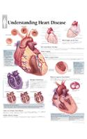 Understanding Heart Disease Laminated Poster