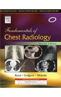 Fundamentals of Chest Radiology, 2/e