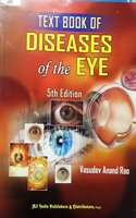 TEXT BOOK OF DISEASES OF THE EYE