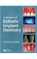 Fundamentals of Esthetic Implant Dentistry