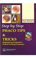 Step by Step Phaco Tips and Tricks [With 2 Mini CDROMs]