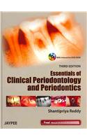 Essentials of Clinical Periodontology and Periodontics