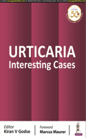 Urticaria