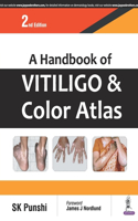 Handbook of Vitiligo and Color Atlas