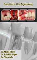 Essentials in Oral Implantology