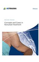 Concepts and Cases in Nonunion Treatment