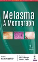 Melasma A Monograph