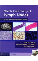 Needle Core Biopsy of Lymph Nodes with DVD-ROM