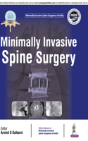 Minimally Invasive Spine Surgery